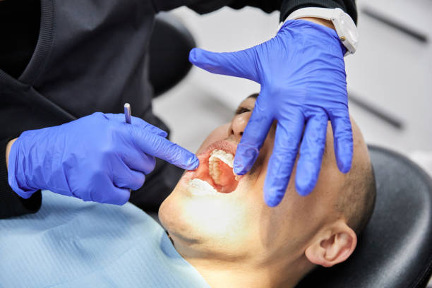 Best Knocked-Out Tooth (Avulsed Tooth) Treatment in Risg Sun, IN